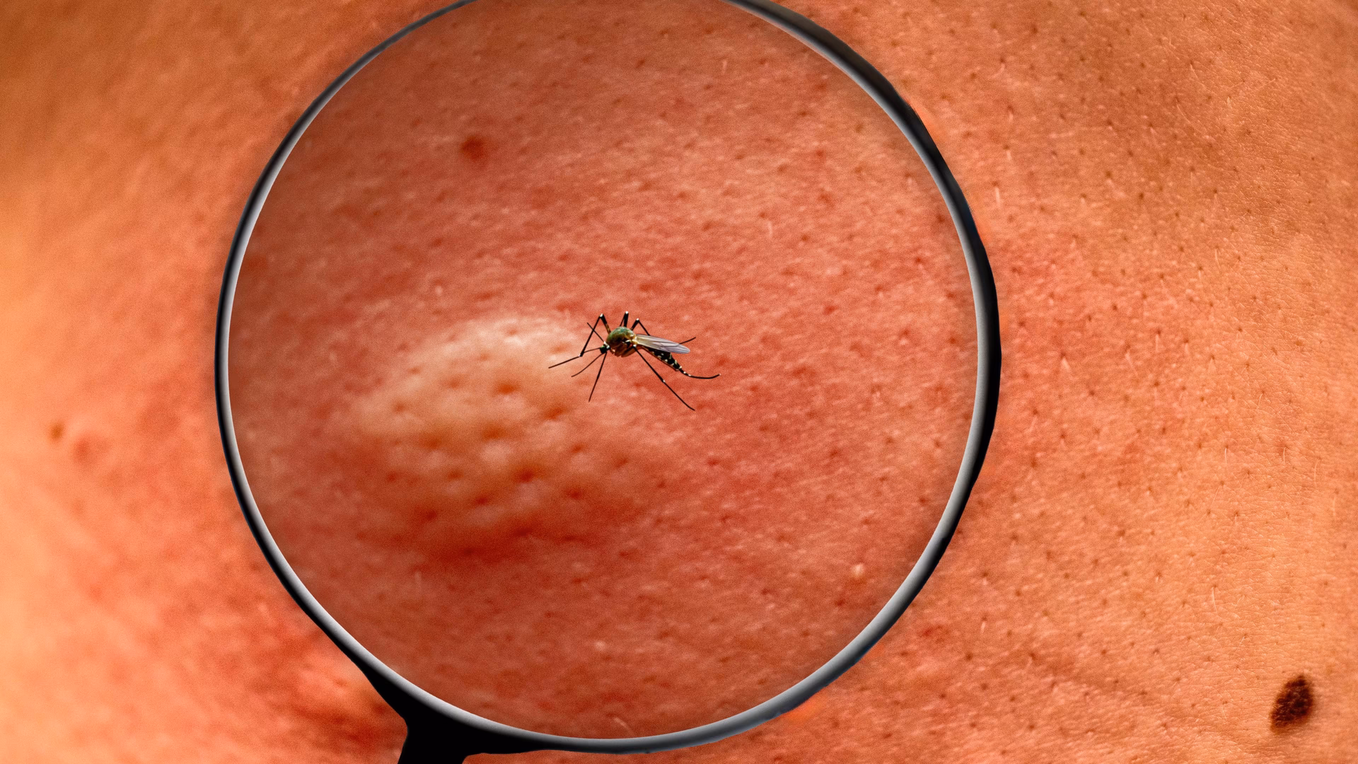 Was bedeutet ein Kreis um einen Mückenstich?